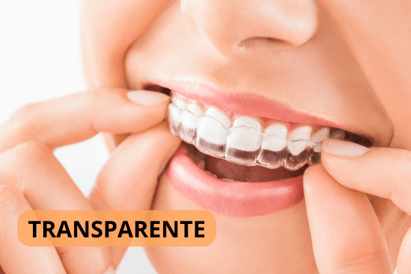 Sorriso de uma mulher com aparelho ortodôntico transparente.
